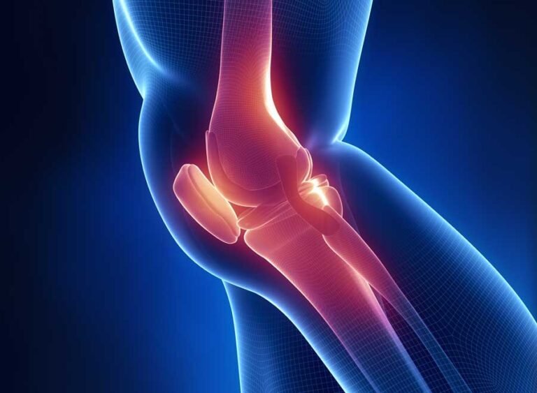 Leading Orthopedic Surgeon for Knee Replacement