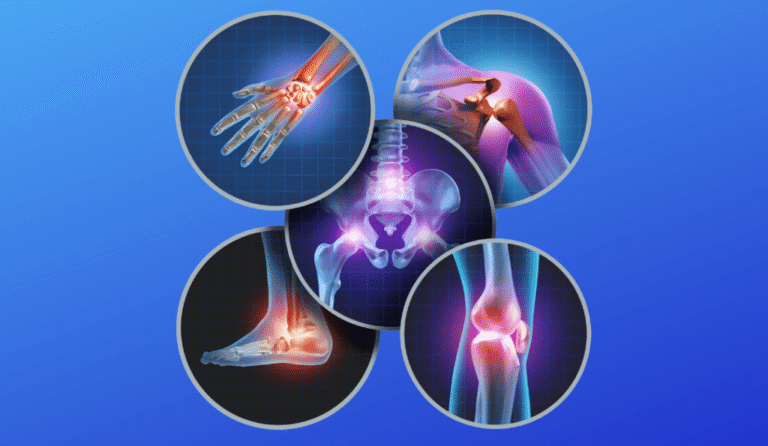Key Orthopedic Conditions Explained: Triggers and Effective Therapies